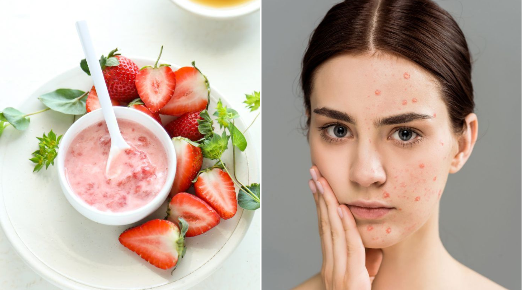 Tips Ampuh Menghilangkan Jerawat : Pakai Masker Buah dan Sayur Bikinan Sendiri!